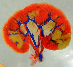 Niere mit gefärbten Blutgefäßen
