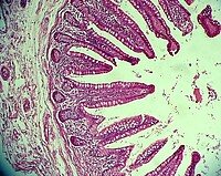 Dünndarm im Querschnitt