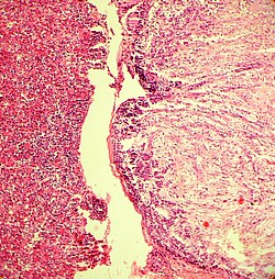 Hirnanhangsdrüse Hypophyse