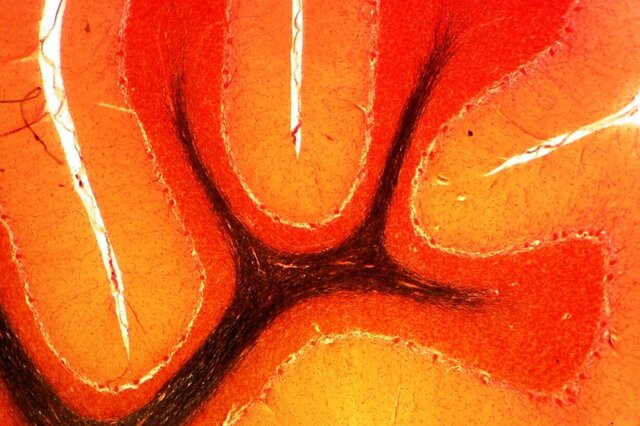 Zu sehen ist eine mikroskopische Aufnahme des Kleinhirns.