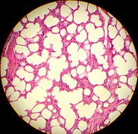 Lungengewebe unter dem Mikroskop