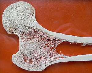 Kopf des Oberschenkelknochens Femur
